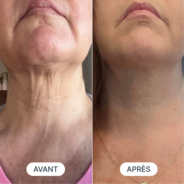 Avant / Après de Claire A.