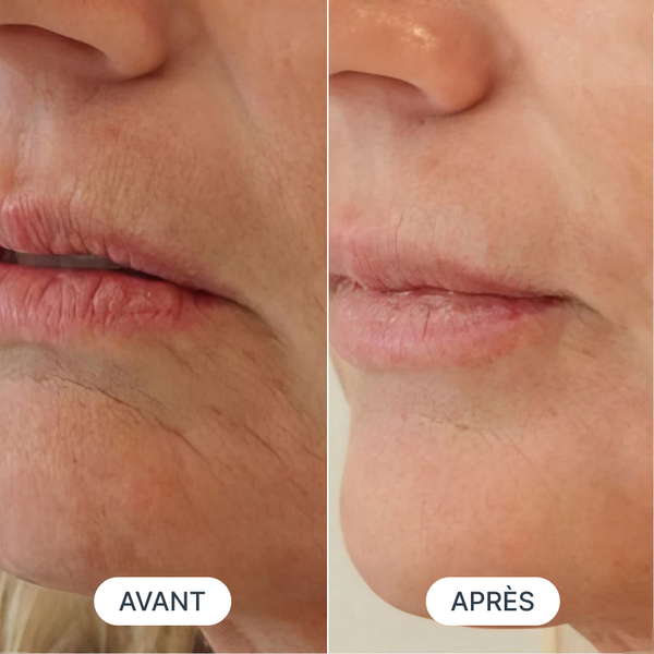 Avant / Après de Sophie P.