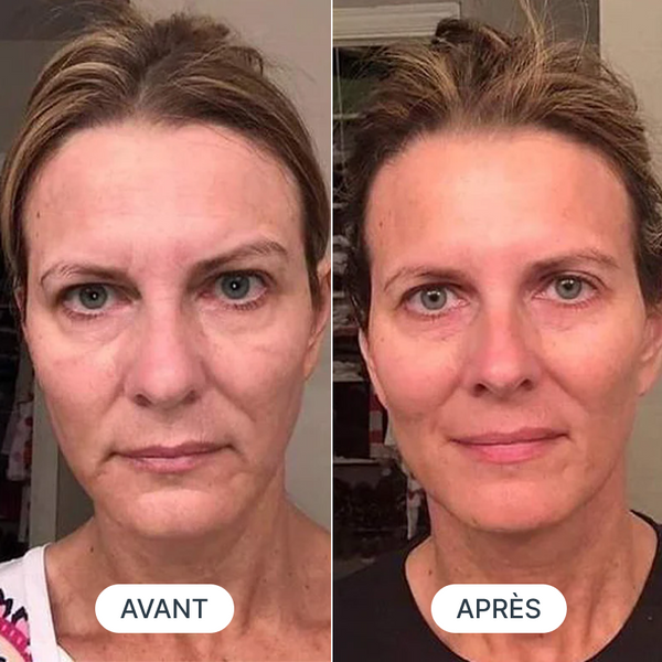 Avant / Après de Élodie W.