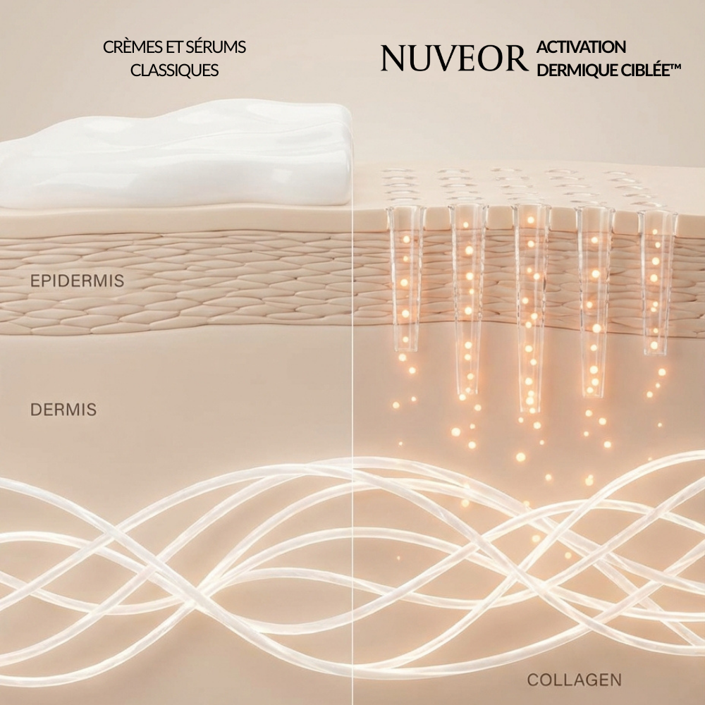 Activation Dermique Ciblée™ | Micro-infusion à domicile