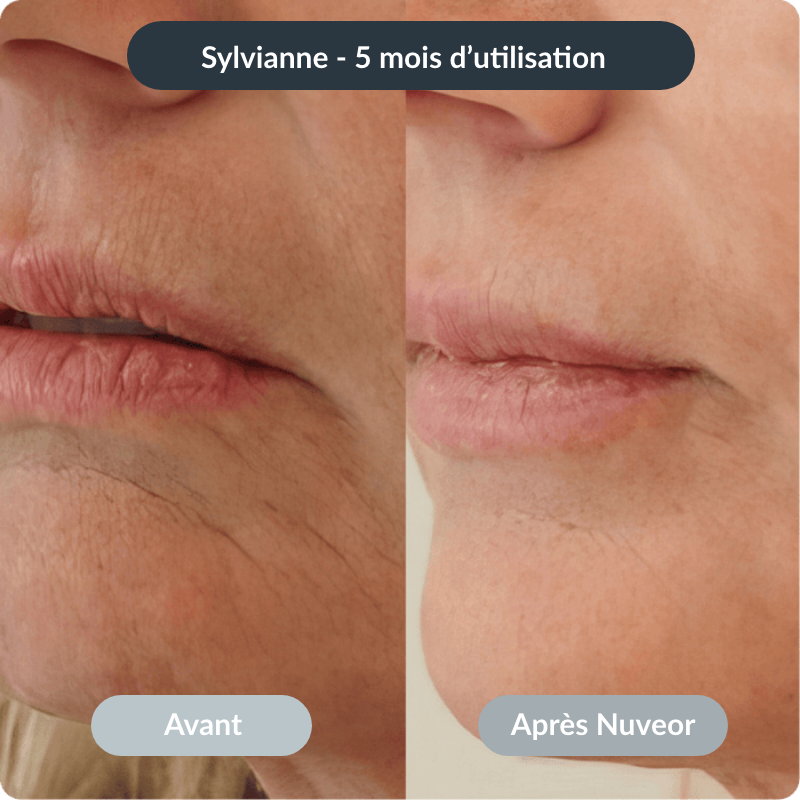 NUVEOR™ | Micro-Infusion Active Anti-Âge