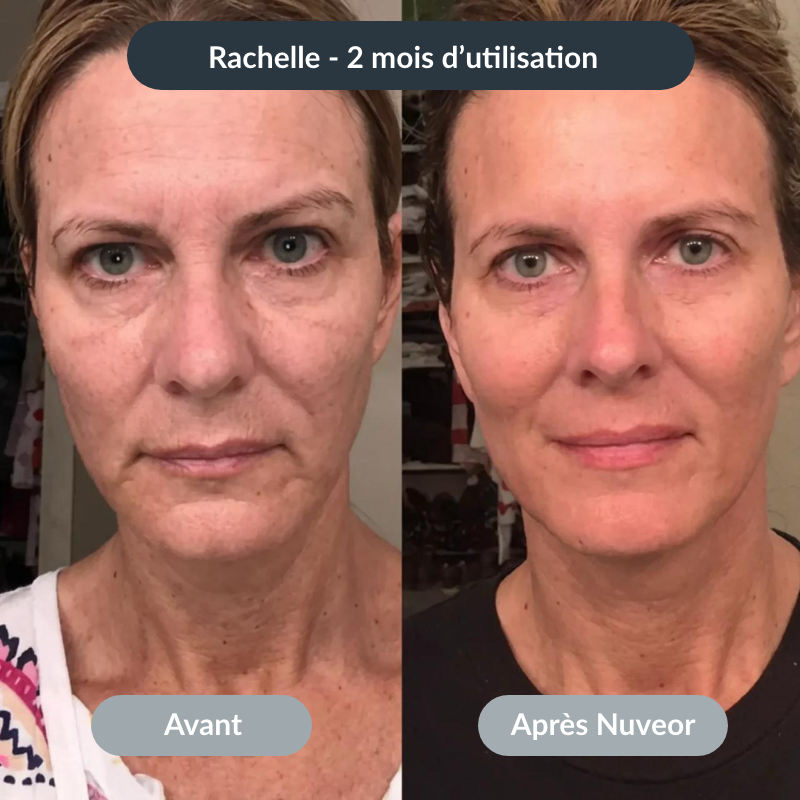 NUVEOR™ | Micro-Infusion Active Anti-Âge