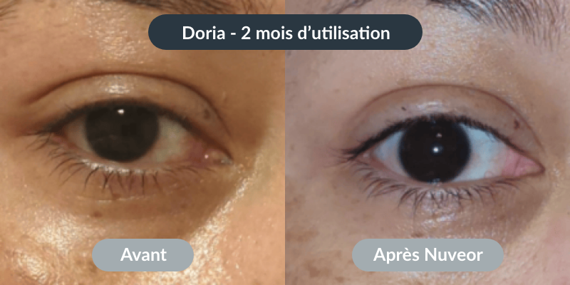 NUVEOR™ | Micro-Infusion Active Anti-Âge