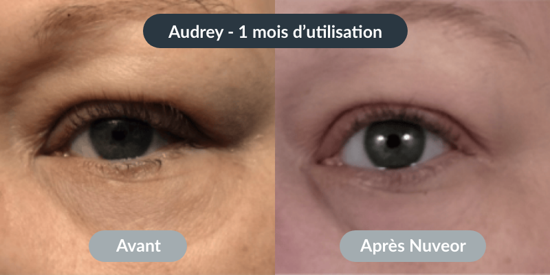 NUVEOR™ | Micro-Infusion Active Anti-Âge